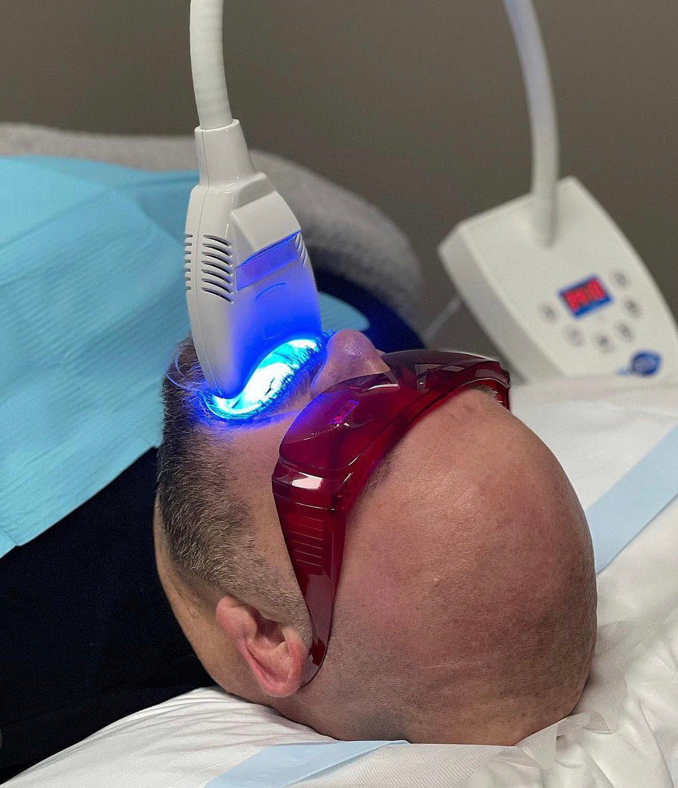 Teeth Whitening Starter Pack