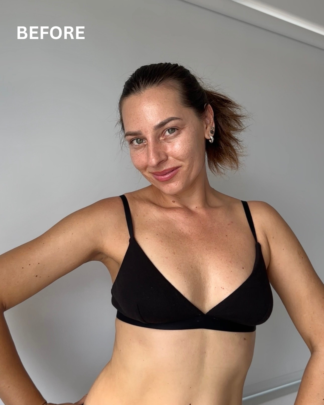 Before applying MS.LOVA self tanning mousse showing natural untanned skin tone.