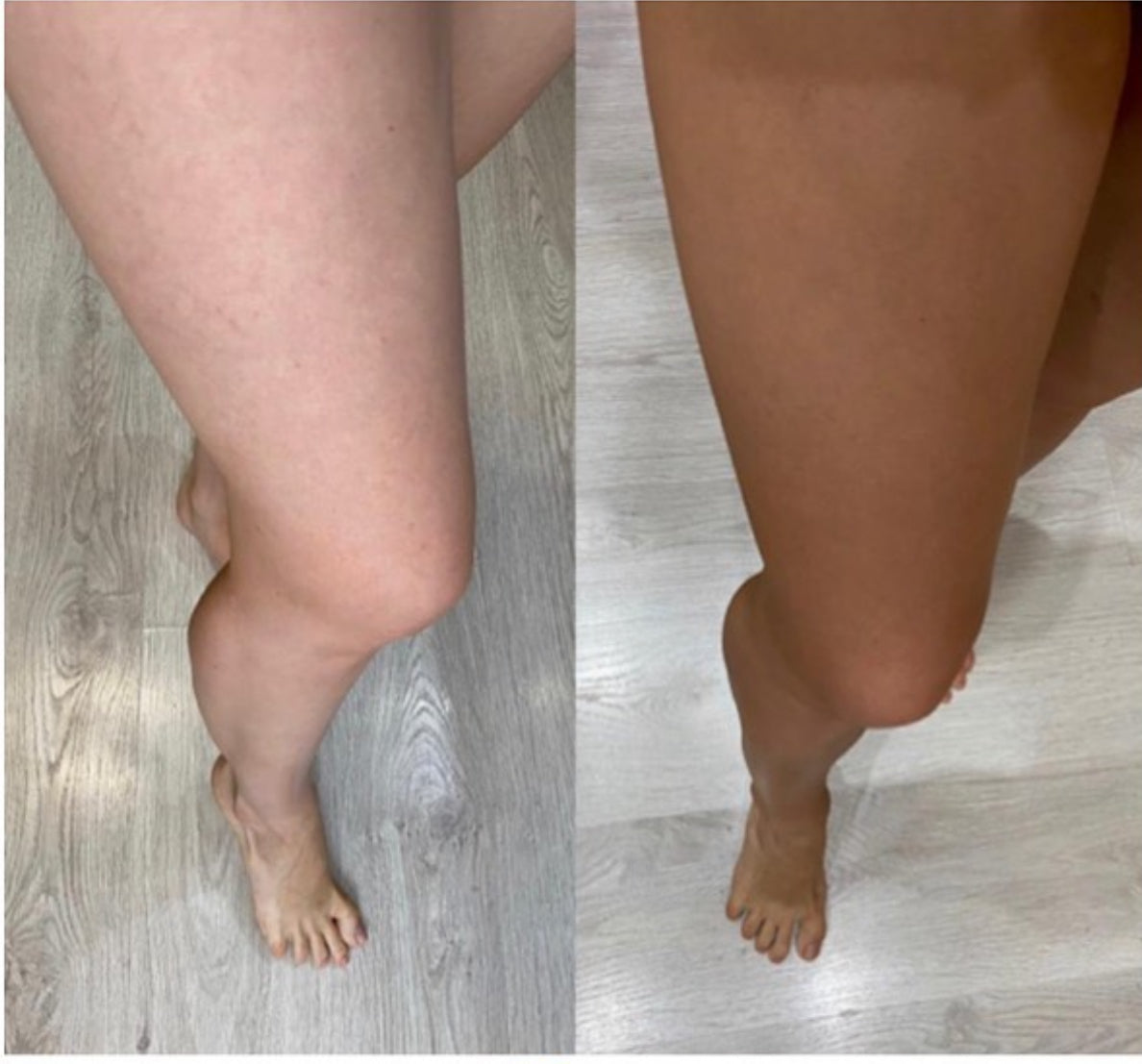 Before and after leg result using Ms. Lova clear-based tanning mousse for a natural, even body glow