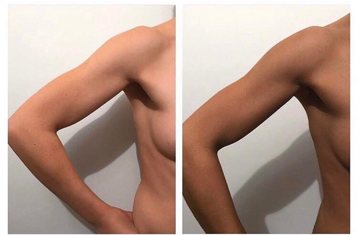 Before and after arm result using Ms. Lova Extra Dark Tanning Mousse for a deeper, even-looking tan.