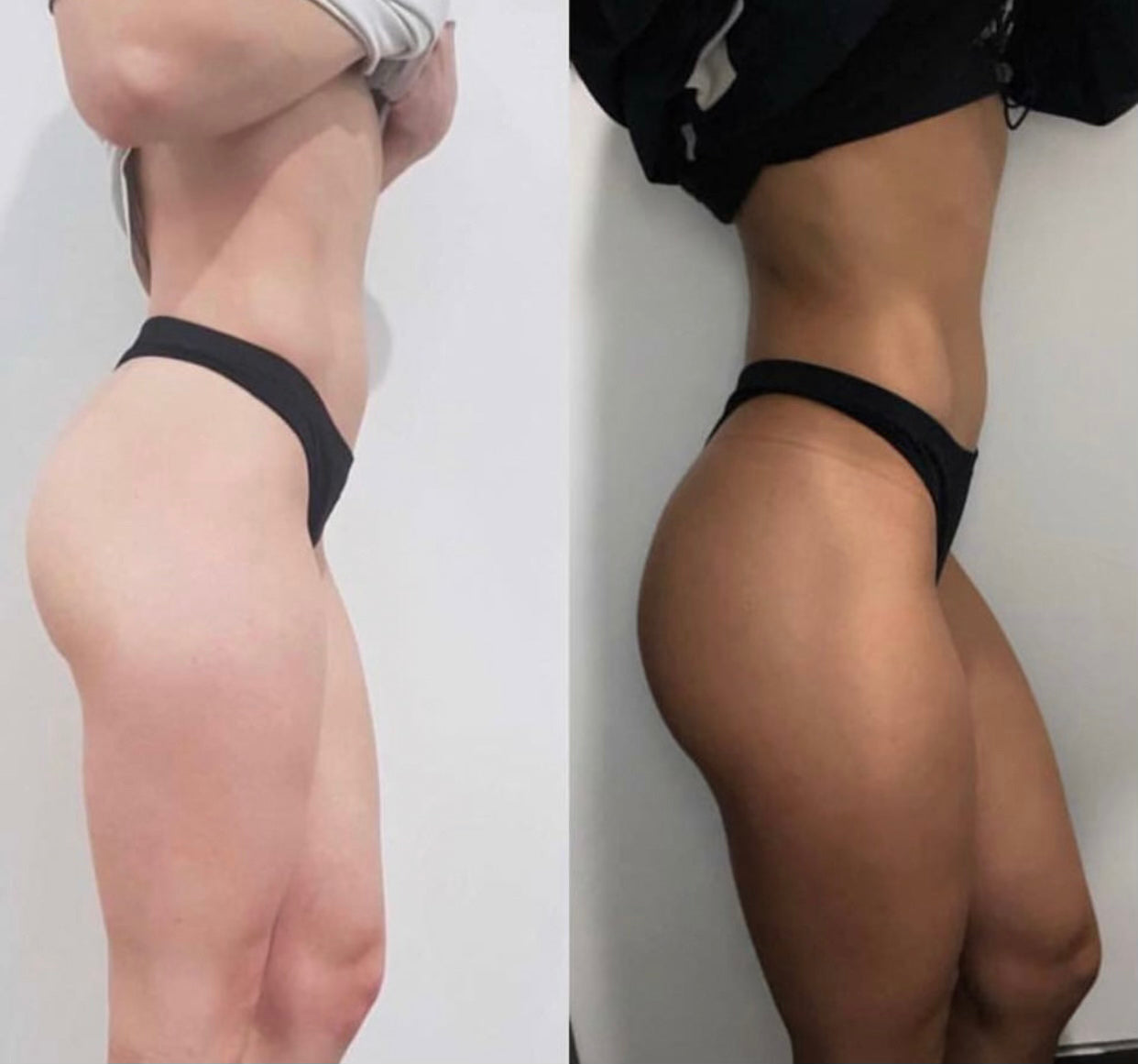 Before and after body result using Ms. Lova Extra Dark Tanning Mousse for a deeper, even-looking tan