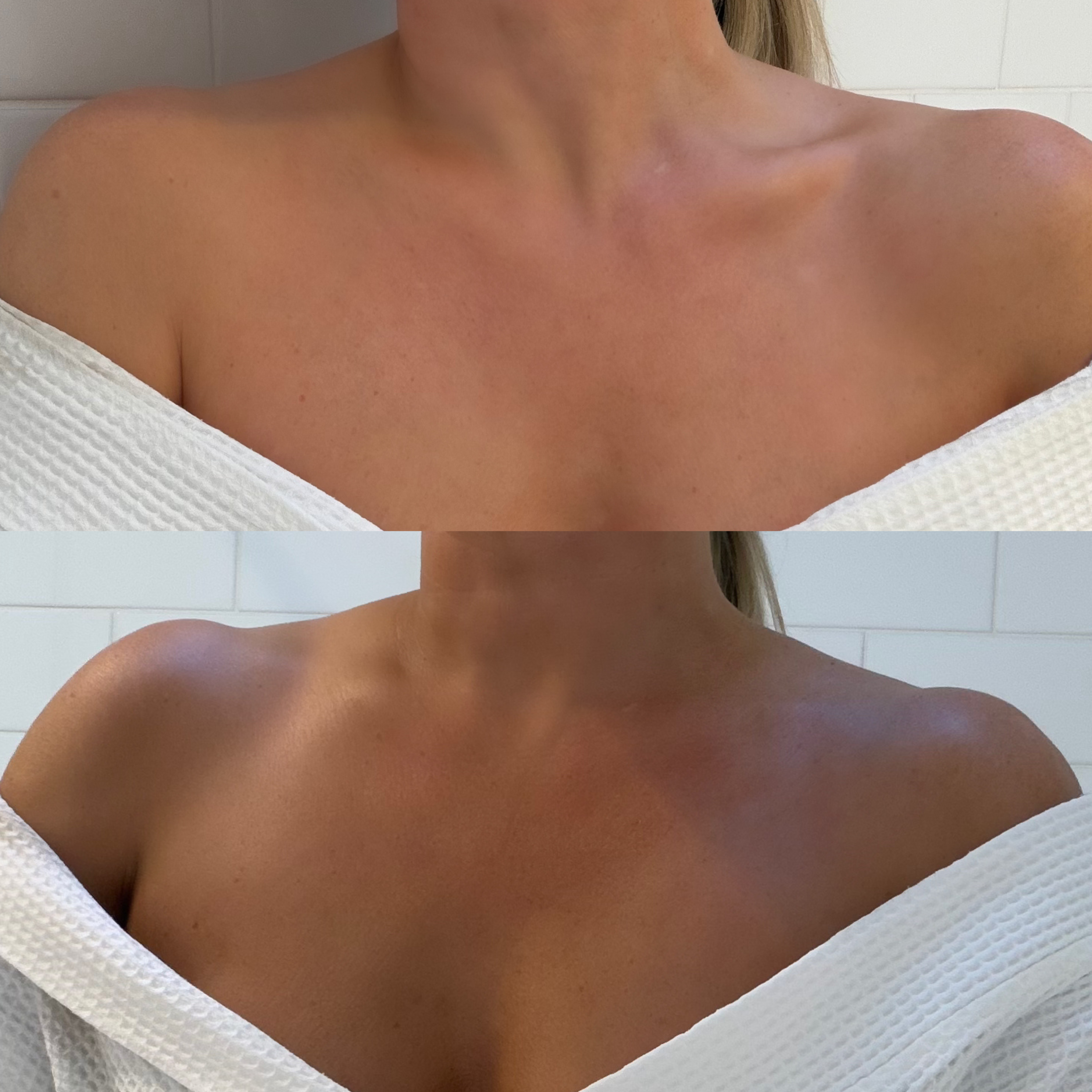 Before and after result using Ms. Lova Extra Dark Tan Mousse for a deeper, even tan on the chest and shoulder area.