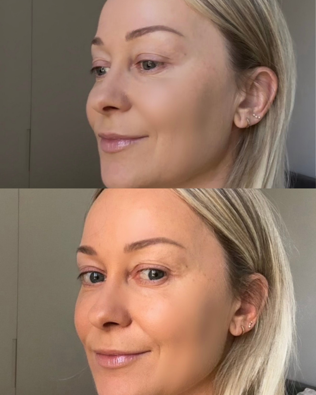 Before and after result using Ms. Lova Face Tan Water for a natural, even self-tanning glow